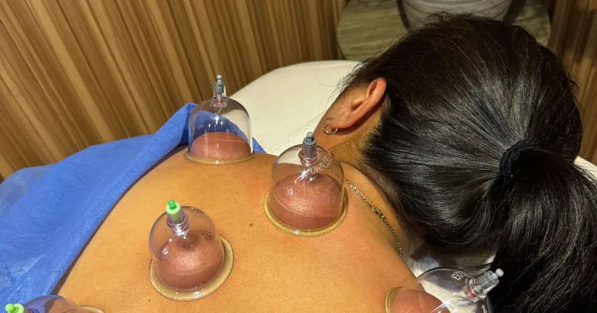 Hijama in Dubai