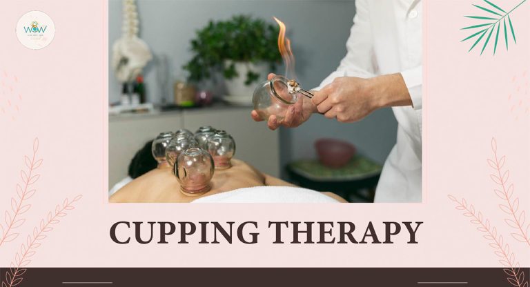 Cupping Therapy Explained: Detox, De-Stress, and Recharge Naturally